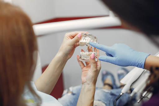 Dental Implants