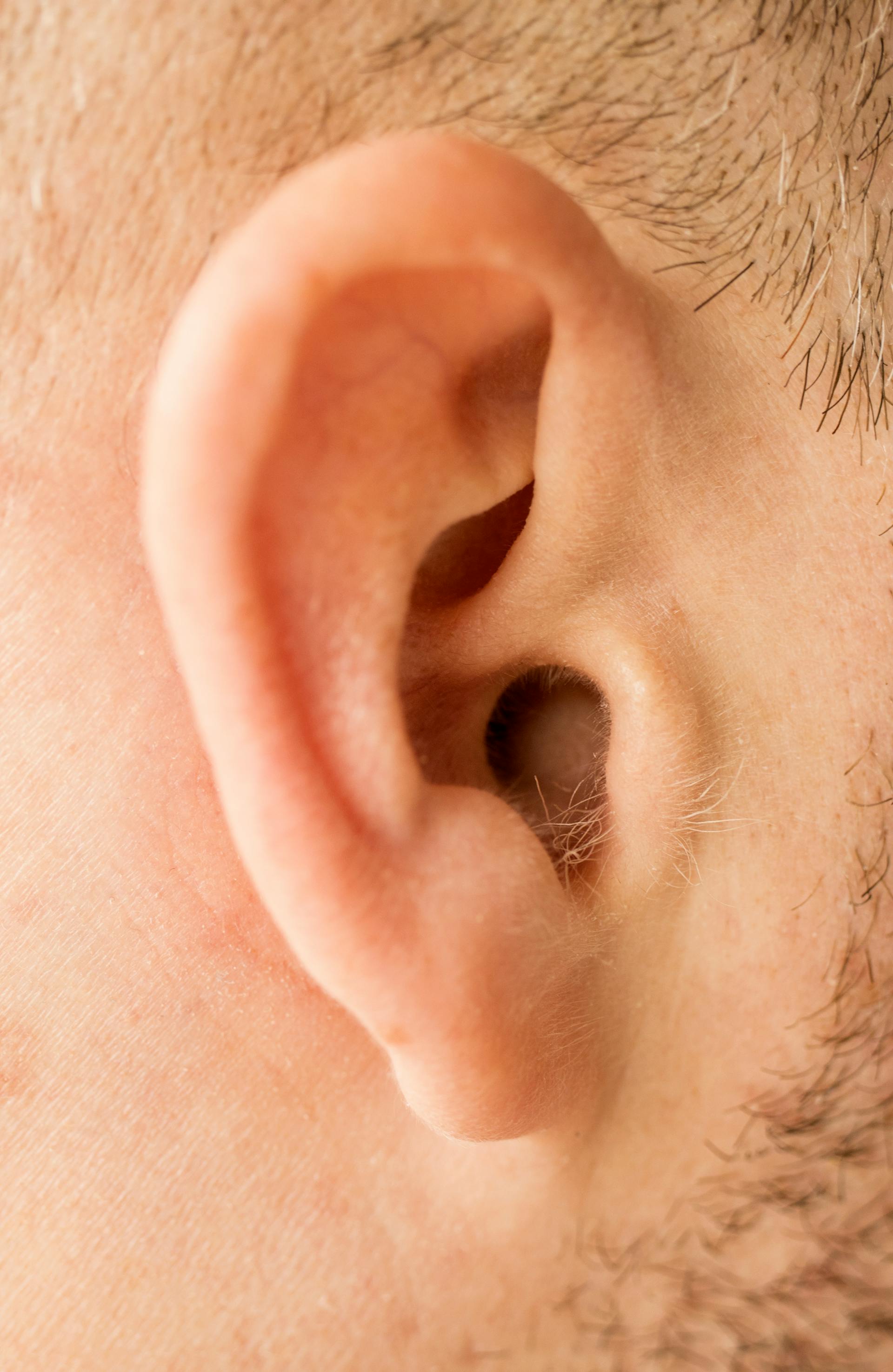 Audiologist at EyeSmile providing hearing care