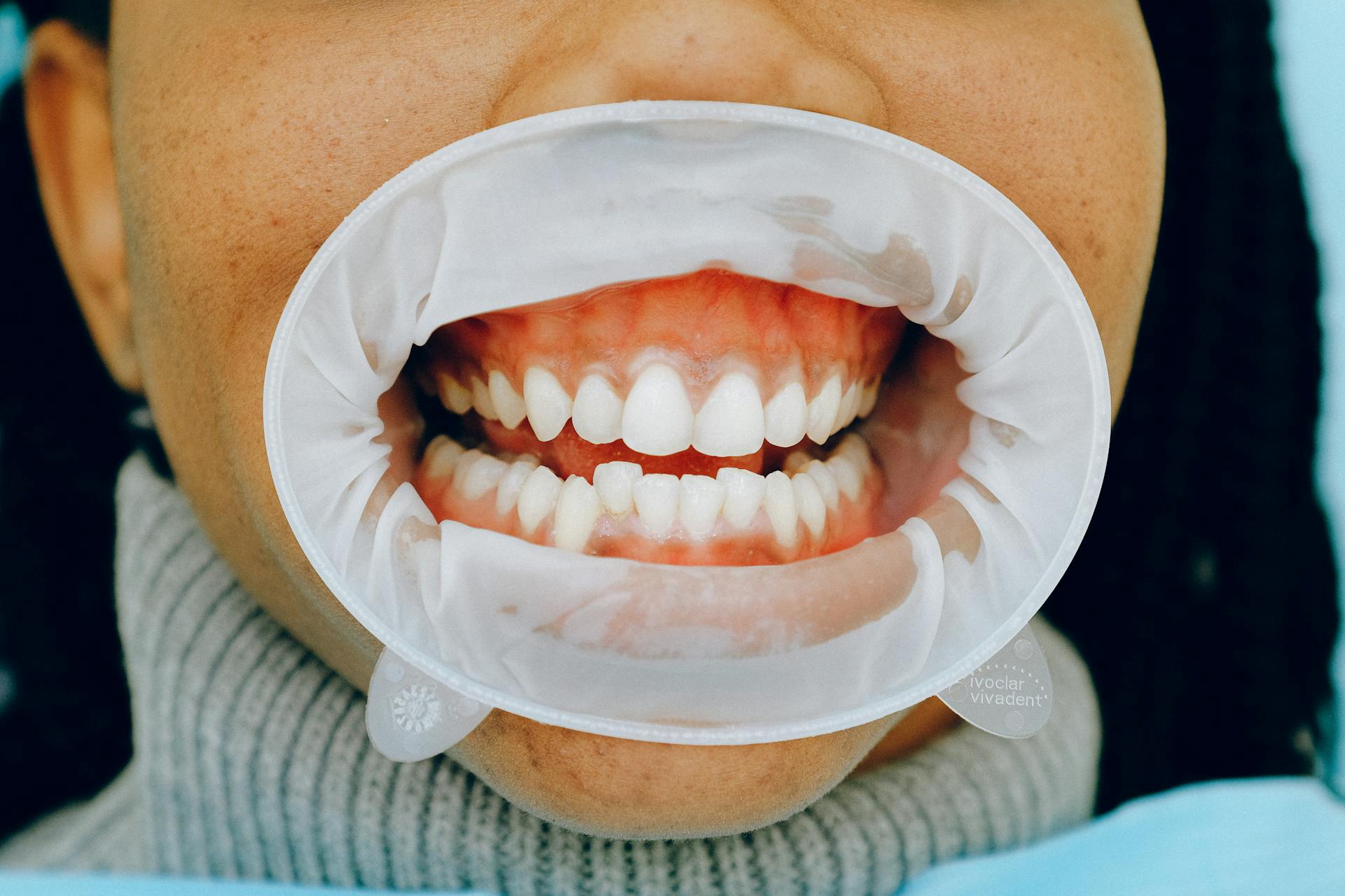 close-up of healthy teeth and gums following gum disease treatment