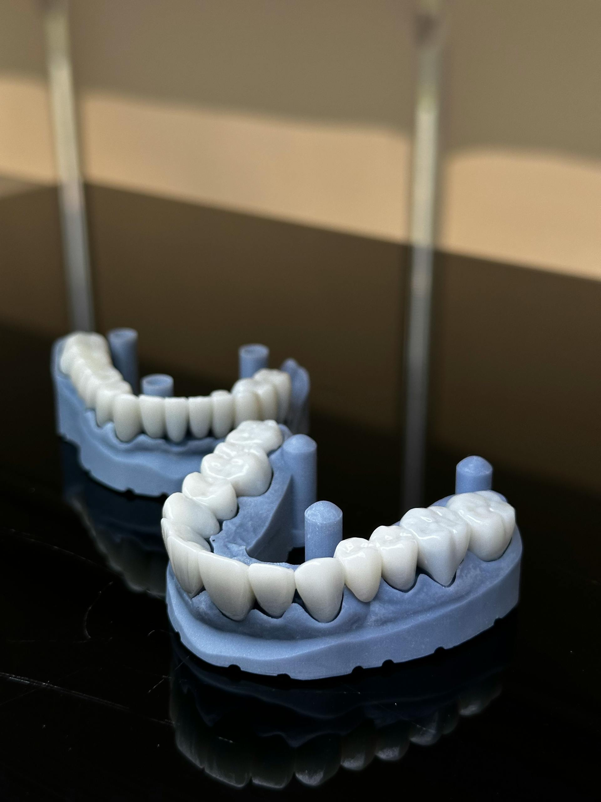 Dental bridge impressions on glossy surface