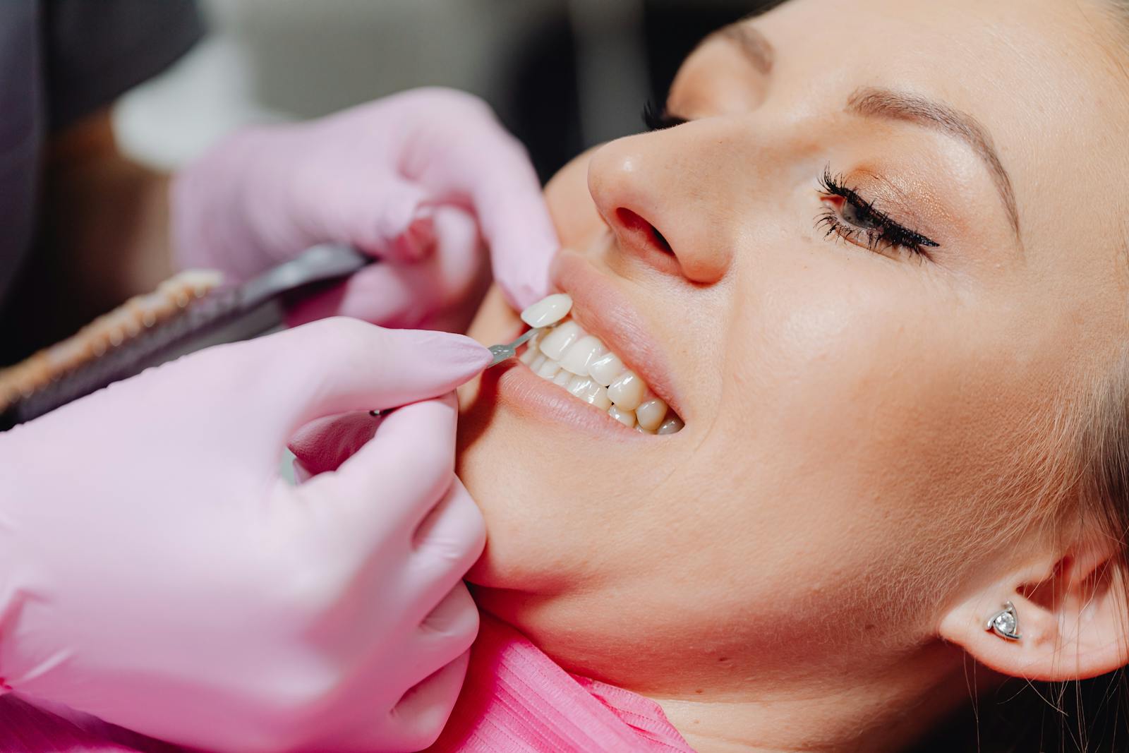 close-up of a natural, healthy smile after cosmetic dental treatment