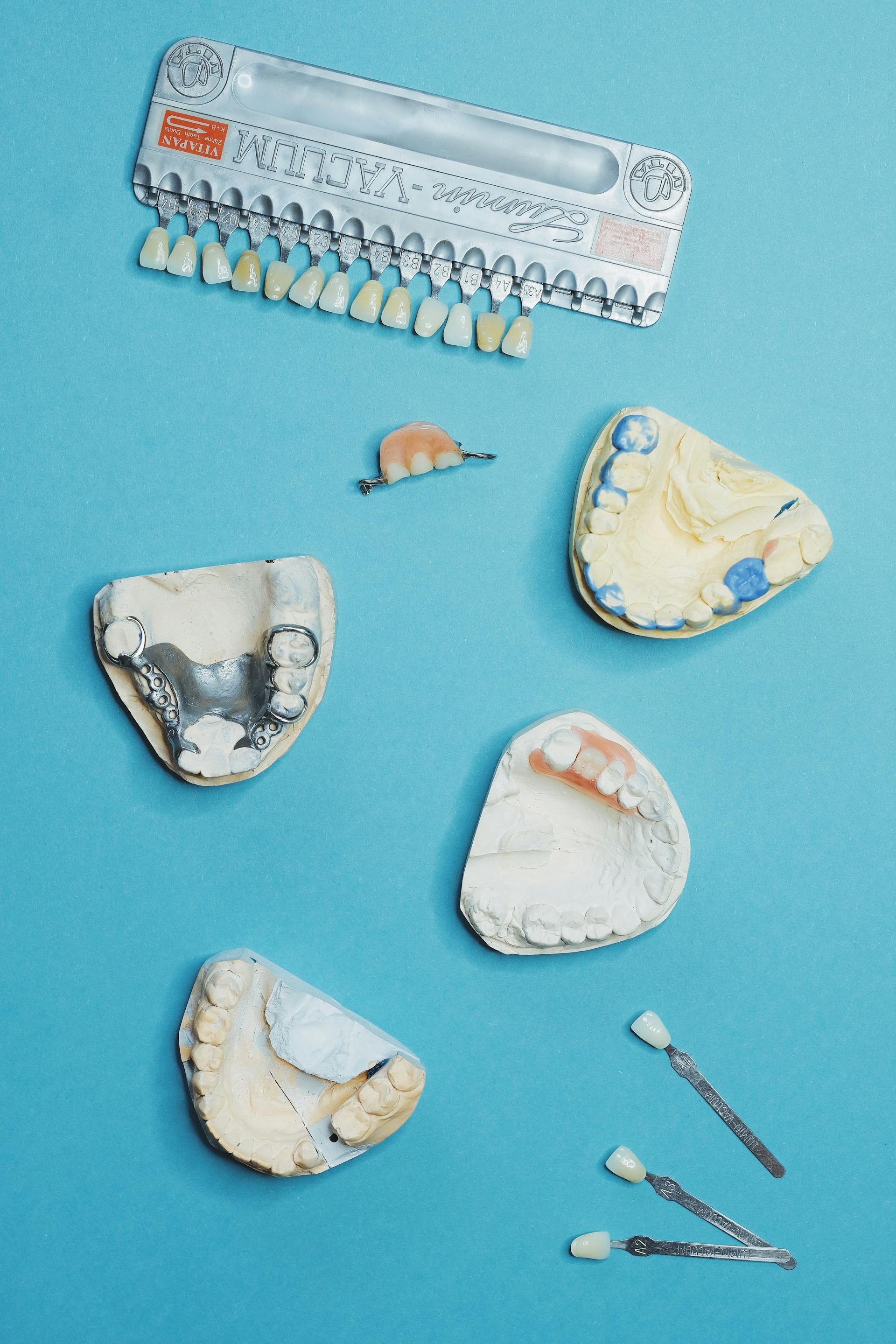 Dental molds and veneer prosthetics