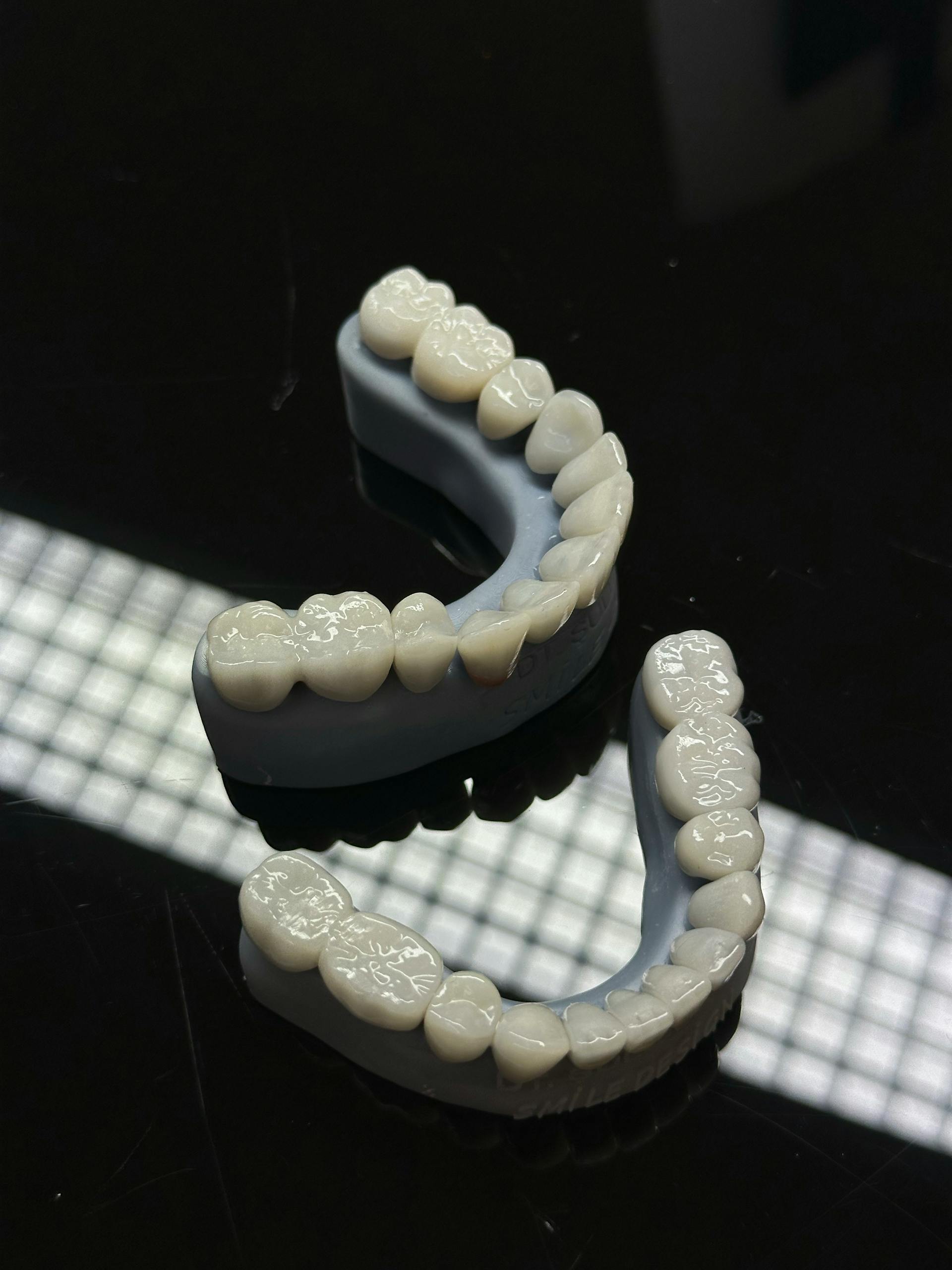 Ceramic crown detail on dark reflective surface