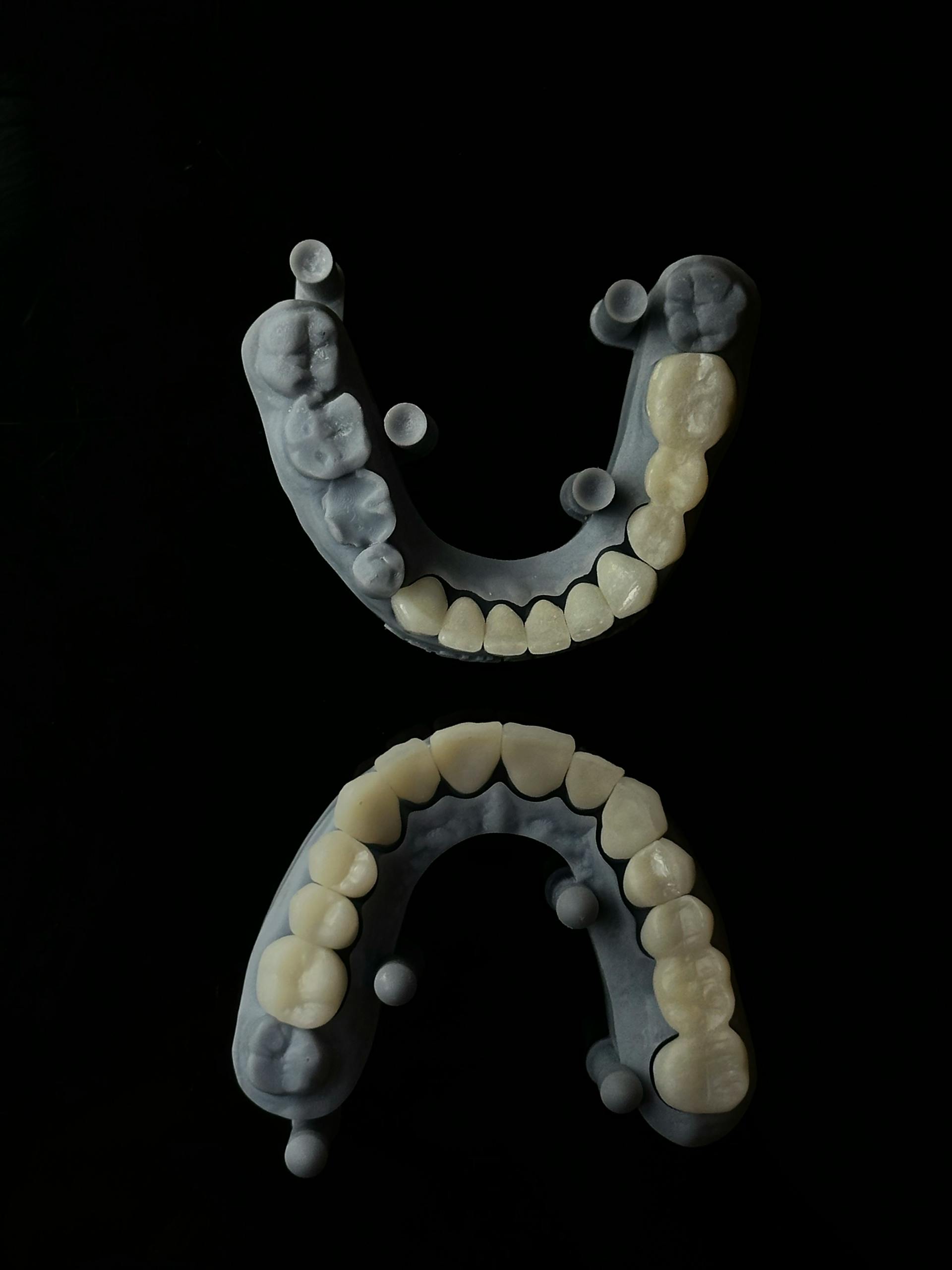 Precision 3D-printed dental restoration models